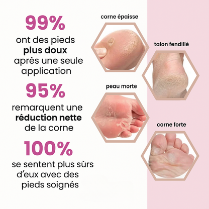 DouxTalons™ — Talons lisses en 2 minutes