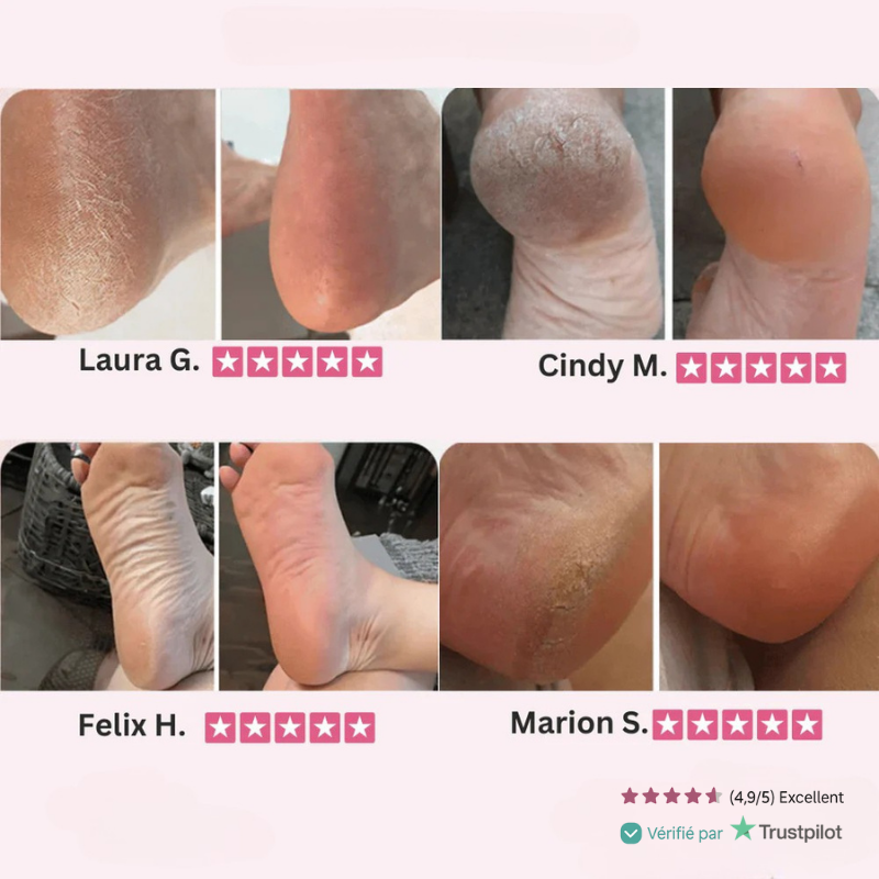 DouxTalons™ — Talons lisses en 2 minutes